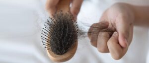Tips Mengatasi Rambut Rontok yang Bisa Anda Coba