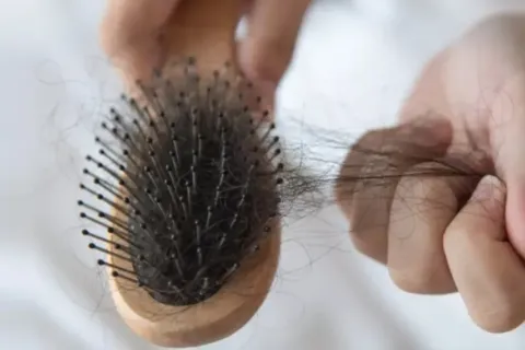 Tips Mengatasi Rambut Rontok yang Bisa Anda Coba