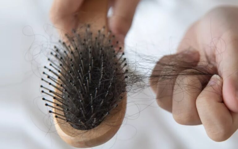 Tips Mengatasi Rambut Rontok yang Bisa Anda Coba