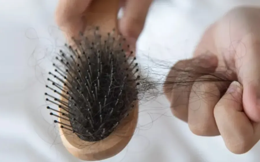 Tips Mengatasi Rambut Rontok yang Bisa Anda Coba