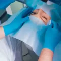 Prosedur LASIK sebagai Solusi Modern untuk Mengatasi Gangguan Penglihatan dan Meningkatkan Kualitas Hidup Anda