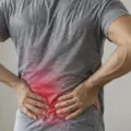 Tips Ampuh Meredakan Nyeri Otot Tanpa Perlu ke Klinik